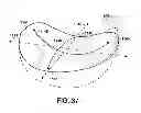 Fig. 32 - ADHESIVELY MOUNTED APPARATUS FOR DETERMINING PHYSIOLOGICAL AND CONTEXTUAL STATUS