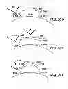 Fig. 35 - ADHESIVELY MOUNTED APPARATUS FOR DETERMINING PHYSIOLOGICAL AND CONTEXTUAL STATUS