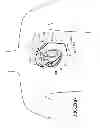Fig. 03 - IMPLANTABLE MYOCARDIAL ISCHEMIA DETECTION, INDICATION AND ACTION TECHNOLOGY