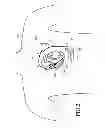 Fig. 06 - IMPLANTABLE MYOCARDIAL ISCHEMIA DETECTION, INDICATION AND ACTION TECHNOLOGY