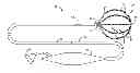 Fig. 01 - Real-time feedback for electrode contact during mapping