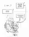 Fig. 02 - Real-time feedback for electrode contact during mapping
