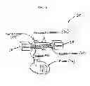 Fig. 03 - System and method for acoustic detection of coronary artery disease and automated editing of heart sound data
