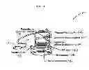 Fig. 04 - System and method for acoustic detection of coronary artery disease and automated editing of heart sound data