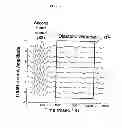Fig. 10 - System and method for acoustic detection of coronary artery disease and automated editing of heart sound data