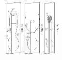 Fig. 02 - Systems and methods for flushing an assessment catheter