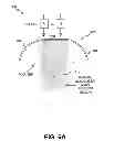 Fig. 09 - Energy based fat reduction