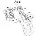 Fig. 06 - HAND ACTIVATED ULTRASONIC INSTRUMENT