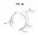 Fig. 08 - HAND ACTIVATED ULTRASONIC INSTRUMENT