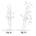 Fig. 04 - NEUROPLASTICITY VERTIGO TREATMENT DEVICE AND METHOD