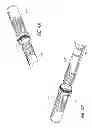 Fig. 05 - Intraocular shunt placement