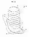 Fig. 03 - IMPLANTABLE FLOW CONNECTOR