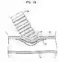 Fig. 08 - IMPLANTABLE FLOW CONNECTOR