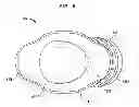 Fig. 12 - IMPLANTABLE FLOW CONNECTOR