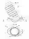 Fig. 13 - IMPLANTABLE FLOW CONNECTOR