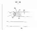 Fig. 20 - IMPLANTABLE FLOW CONNECTOR
