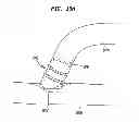 Fig. 24 - IMPLANTABLE FLOW CONNECTOR