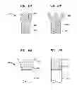 Fig. 32 - IMPLANTABLE FLOW CONNECTOR