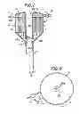 Fig. 02 - Fail-safe insufflators