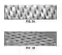 Fig. 04 - Microarray for delivery of therapeutic agent and methods of use
