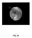 Fig. 06 - Opacity technology