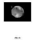 Fig. 07 - Opacity technology