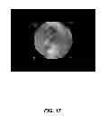 Fig. 08 - Opacity technology