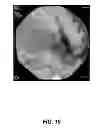 Fig. 10 - Opacity technology