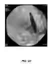 Fig. 11 - Opacity technology