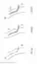 Fig. 09 - Variable length catheter for drug delivery