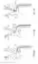 Fig. 10 - Variable length catheter for drug delivery