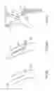 Fig. 12 - Variable length catheter for drug delivery