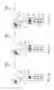 Fig. 19 - Variable length catheter for drug delivery