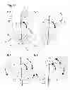 Fig. 32 - Dosing unit for an ambulatory infusion device