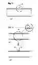 Fig. 09 - Needle safety device