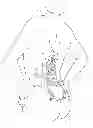 Fig. 01 - Anchor and anchor deployment apparatus