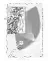 Fig. 01 - Negative pressure wound closure device