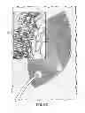 Fig. 11 - Negative pressure wound closure device