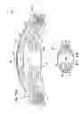 Fig. 15 - Negative pressure wound closure device