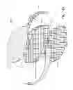 Fig. 19 - Negative pressure wound closure device