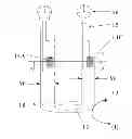Fig. 01 - CATHETER WITH PRESSURE SENSOR SYSTEM