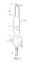 Fig. 02 - Dilation device for placing catheter tubes