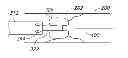 Fig. 01 - Variable length catheter for drug delivery