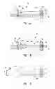 Fig. 06 - Variable length catheter for drug delivery