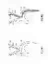 Fig. 11 - Variable length catheter for drug delivery