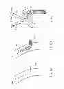 Fig. 15 - Variable length catheter for drug delivery