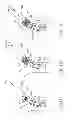 Fig. 17 - Variable length catheter for drug delivery
