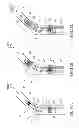 Fig. 18 - Variable length catheter for drug delivery
