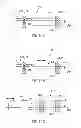 Fig. 26 - Variable length catheter for drug delivery