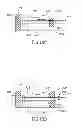 Fig. 30 - Variable length catheter for drug delivery